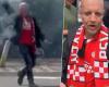 Terrible images: PSV supporter mistakes torch for fireworks arrow and loses part of his hand | Foreign Football